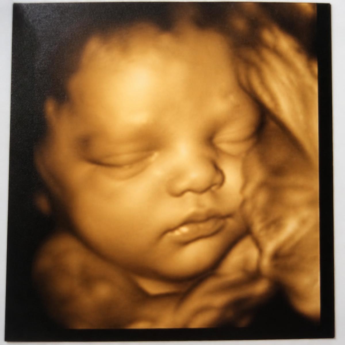 Warm-toned 4D ultrasound keepsake print of a baby's face